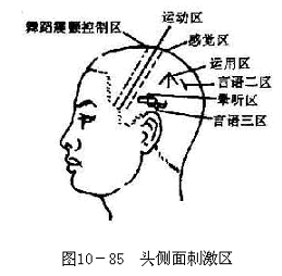 头部针灸运动区图图片